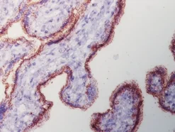 Duolink In Situ Detection Reagents Brightfield