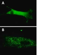 Биосенсор лентивирусный GFP-p62