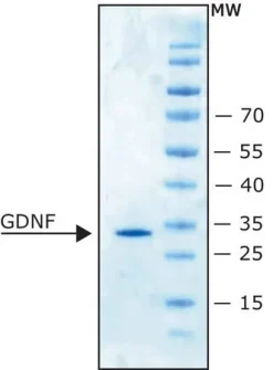 Нейротрофический фактор глиальных клеток человека (GDNF)