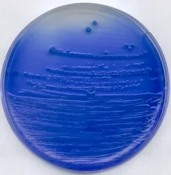 Агар с китайским голубым и лактозой (China Blue Lactose Agar)