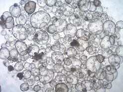 Органоиды толстой кишки (Colon Intestinal Organoids)