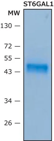 Бета-галактозид альфа-2,6-сиалилтрансфераза 1 (ST6Gal I)