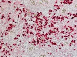 Антитело к человеческому IgA (специфичное к α-цепи), конъюгированное со щелочной фосфатазой (козлиное)