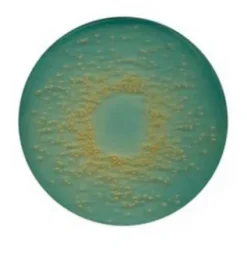 CLED-агар (Cystine-Lactose-Electrolyte Deficient Agar)