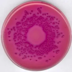 Агар VRBD (Violet Red Bile Dextrose)