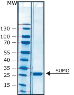 SUMO-протеаза (Ubl-специфичная протеаза 1)
