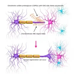 Хондроитиназа ABC из Proteus vulgaris
