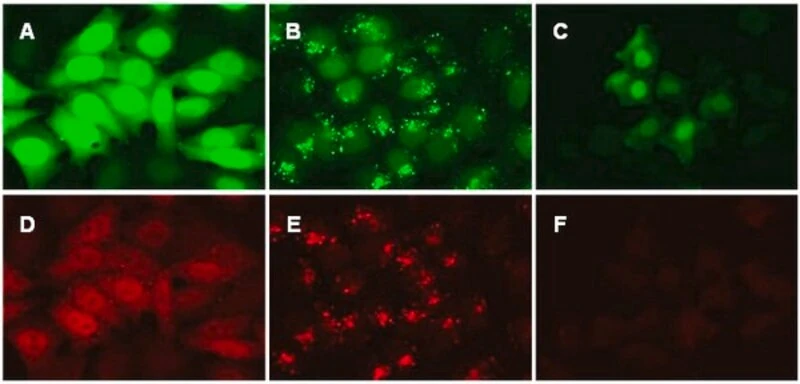 LentiBrite GFP-LC3 лентивирусный биосенсор