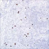 Антитело поликлональное кроличье к фосфогистону H3 (PHH3)