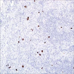 Антитело поликлональное кроличье к фосфогистону H3 (PHH3)