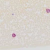 Набор для выявления лейкоцитарной эстеразы (Naphthol AS-D Chloroacetate, специфическая эстераза)