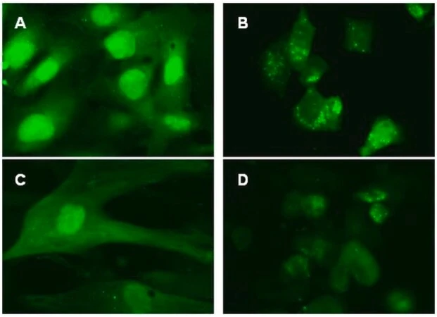 LentiBrite GFP-LC3 лентивирусный биосенсор