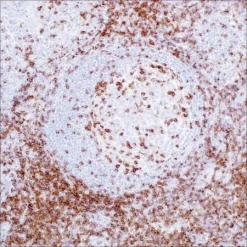 Моноклональное антитело мыши CD2 (MRQ-11)