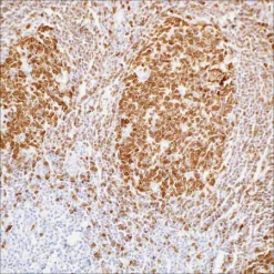Моноклональное антитело BOB.1 (SP92), кроличье