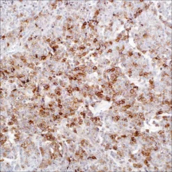 Моноклональное антитело мыши CD25 (4C9)