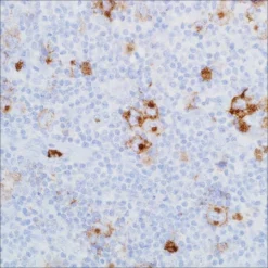 Антитело мышиное моноклональное CD15 (MMA)