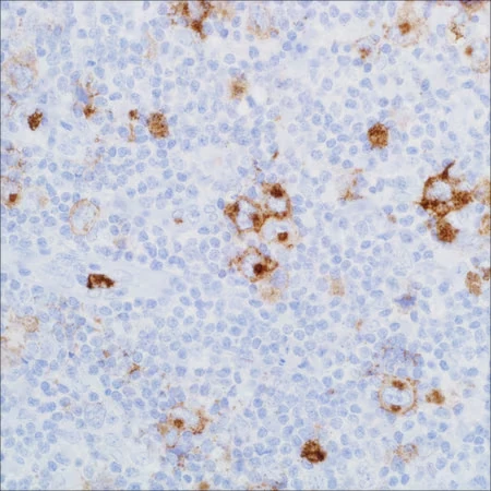 Антитело мышиное моноклональное CD15 (MMA)