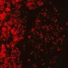 Набор для окрашивания AFB-Fluor без фенола (окраска аурамин-родамин) для флуоресцентной микроскопии