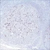 Антитело моноклональное мышиное CD57 (NK-1)