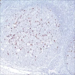 Антитело моноклональное мышиное CD57 (NK-1)