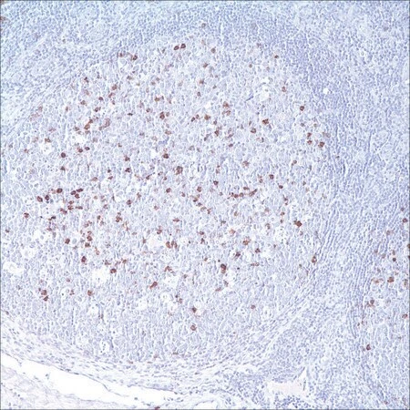 Антитело моноклональное мышиное CD57 (NK-1)