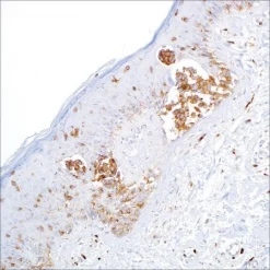 Моноклональное антитело мыши CD63 (NKI/C3)