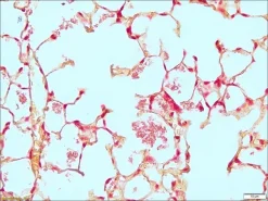 Контрольные предметные стекла TISSUE-TROL™ для окраски по Граму, срез ткани легкого мыши, содержащий Staphylococcus