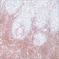 Антитело моноклональное мышиное CD43 (MT1)