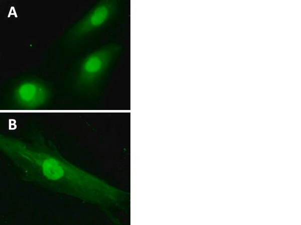LentiBrite GFP Control лентивирусный биосенсор
