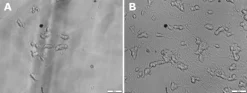 BDNF человеческий, рекомбинантный, экспрессирован в E. coli, без носителя