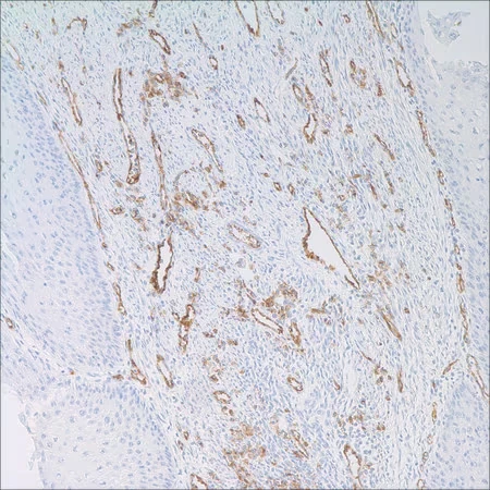 Антитело мышиное моноклональное CD31 (JC70)