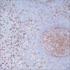 Антитело CD14 (EPR3653) моноклональное кроличье