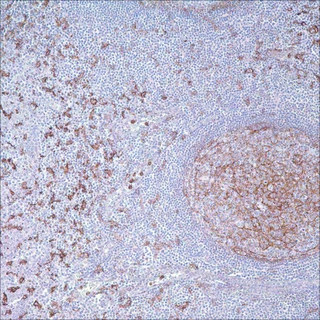 Антитело CD14 (EPR3653) моноклональное кроличье