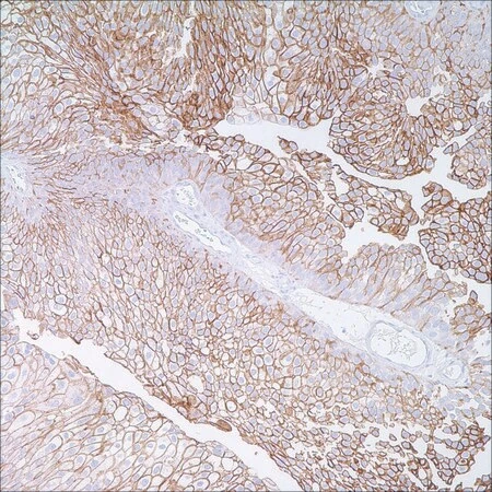 Моноклональное антитело мыши Thrombomodulin (1009)