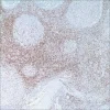 Антитело мышиное моноклональное CD45RO (UCHL-1)