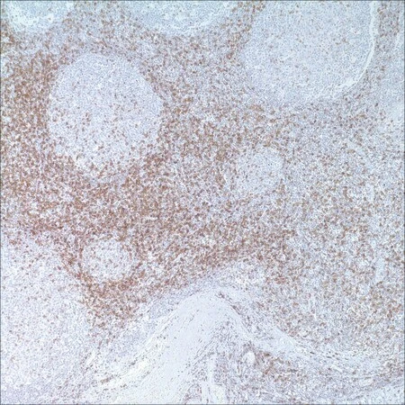 Антитело мышиное моноклональное CD45RO (UCHL-1)