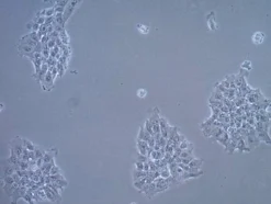 Линия клеток UM-SCC-17A (плоскоклеточная карцинома головы и шеи)