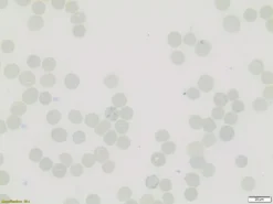 Ретикулоцитарный краситель (Новый метиленовый синий)
