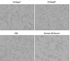 PLTGold® Human Platelet Lysate, 100 мл
