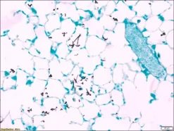 Контрольные слайды Fungi TISSUE-TROL™, мышиное легкое с Candida albicans