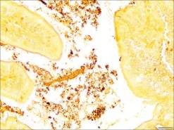 Контрольные слайды Helicobacter TISSUE-TROL™, ткань кишечника мыши с Helicobacter pylori