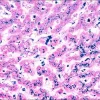 Контрольные слайды Iron TISSUE-TROL™, ткань печени человека