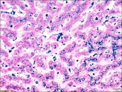 Контрольные слайды Iron TISSUE-TROL™, ткань печени человека