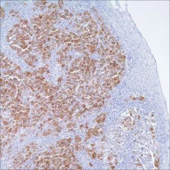 Моноклональное антитело мыши MART-1 (Melan A) (M2-7C10)