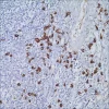 Моноклональное антитело IgG4 (MRQ-44), мышиное