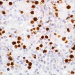 Моноклональное антитело FoxP1 (SP133), кроличье