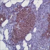 Моноклональное антитело LMO2 (SP51), кроличье