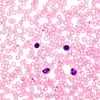 Hemacolor® Раствор 2: красный реагент для быстрого окрашивания мазков крови