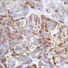 HBME-1 (HBME-1) мышиное моноклональное антитело