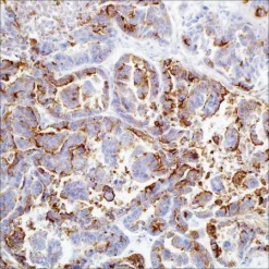 HBME-1 (HBME-1) мышиное моноклональное антитело